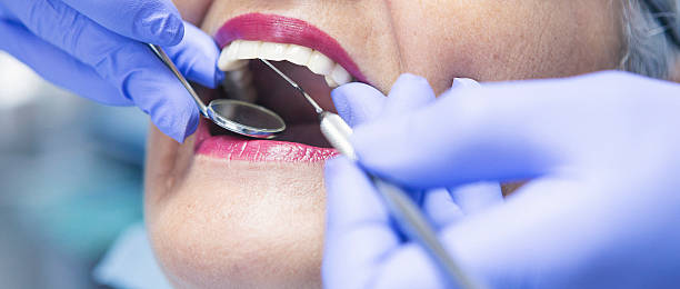 Best Emergency Root Canal Treatment in Sandusky, MI