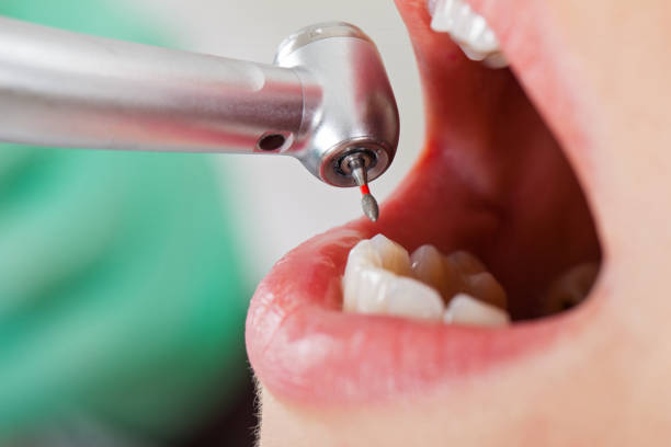 Best Emergency Treatment for Toothache in Sandusky, MI
